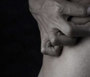 Grain beauté qui gratte : causes et signes d’alerte